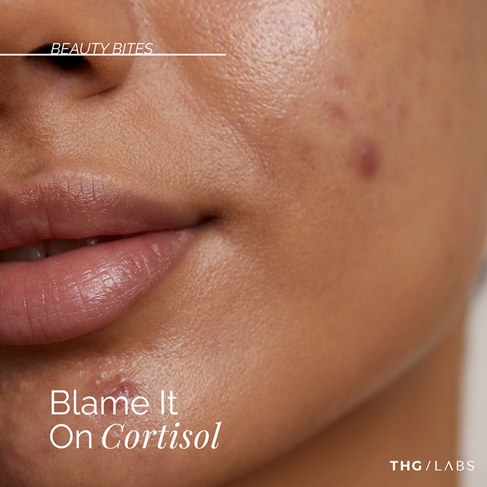  Graphic showing rising cortisol levels and their link to stressed skin.