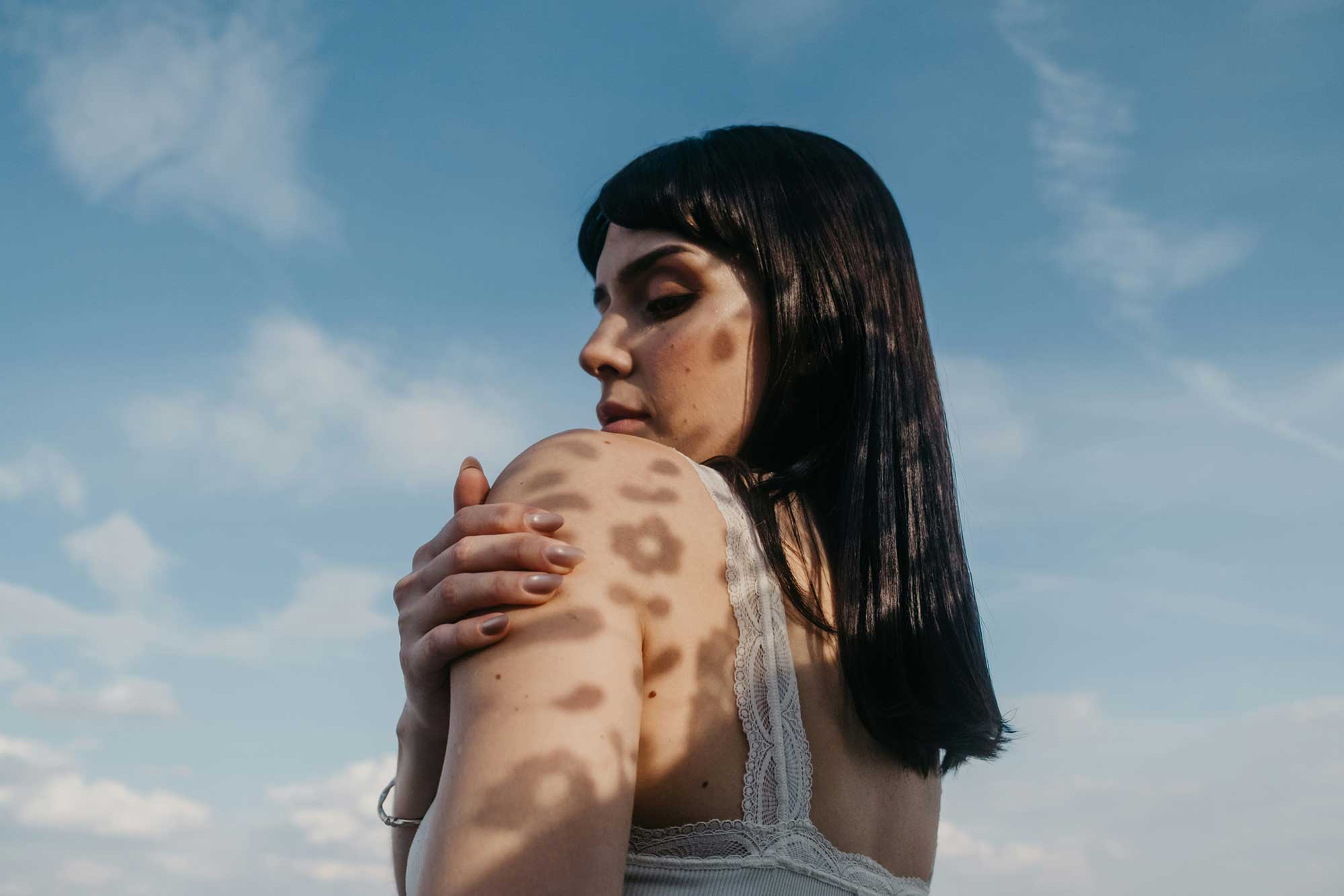 Woman in natural sunlight illustrating daily UV exposure, photoageing and the importance of everyday SPF for long-term skin health.