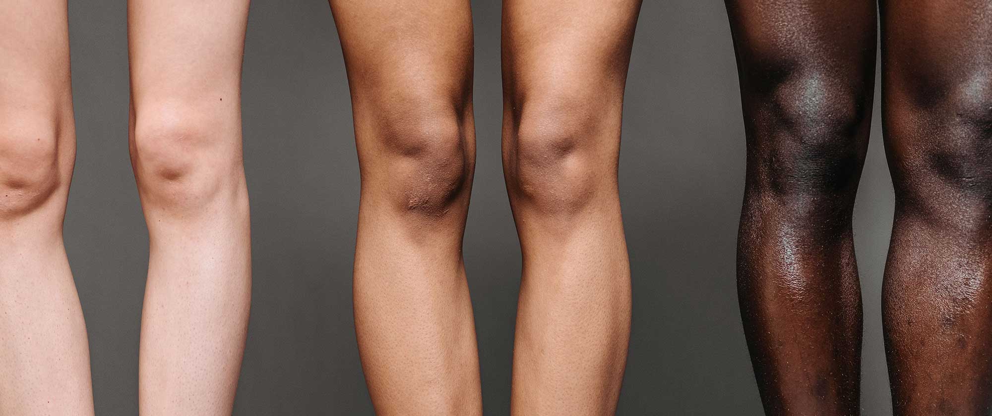 Diverse skin tones illustrating the growing opportunity for inclusive body care product development and targeted skincare innovation explored by THG LABS.