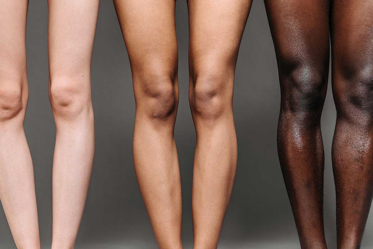 Diverse skin tones illustrating the growing opportunity for inclusive body care product development and targeted skincare innovation explored by THG LABS.