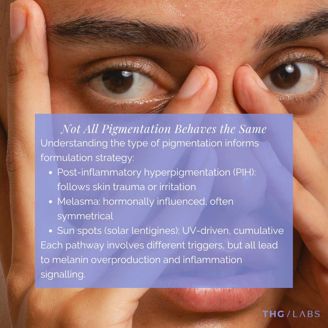 Educational skincare visual explaining different forms of hyperpigmentation including post-inflammatory pigmentation, melasma and sun spots
